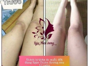 Trị thâm Ngọc Thiên Hương