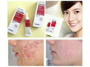 Kem Trị Mụn Shiseido Pimplit Nhật Bản