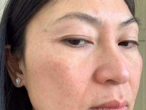 Mỹ phẩm Thanh dược đặc trị tàn nhang