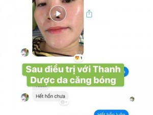 Trị mụn