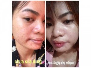 Collagen Aimé rose