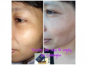 Collagen Aimé rose