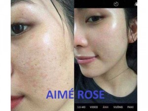 Colagel Aime rose