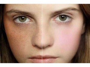 Keva Collagen làm đẹp da