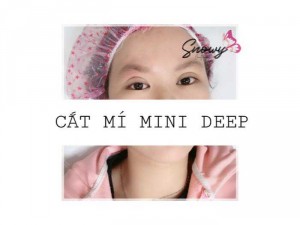 Sale Cắt Mí Mini Deep Chỉ 1Triệ999K