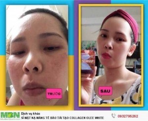Sỉ 3 Mặt Nạ Collagen Olee White