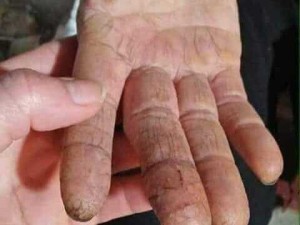 Mỡ trăn cao cấp hàng đặc trị
