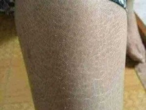 Mỡ trăn cao cấp hàng đặc trị