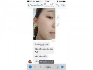 Nạ yến Vychi