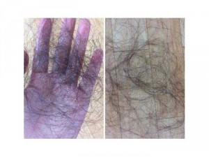 Combo trị rụng tóc, mọc tóc
