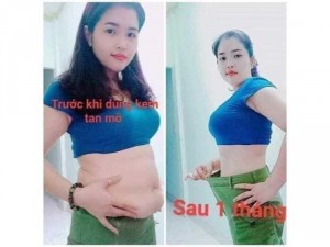 Giảm Eo Đón Tết Cùng Kem Tan Mỡ 3D