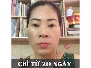 Đặc trị nám lancomai