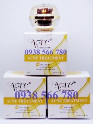 Kem trị mụn NAC ACNE TREATMENT là Cao thủ diệt mụn phục hồi da hoàn hảo được ưa chuộng và đánh giá cao về tính an toàn và hiệu quả trong điều trị mụn thâm nhờ có nguồn gốc từ tự nhiên. Tuy nhiên bạn cần kiên trì thoa kem 1-2 lần/ ngày tùy theo tình trạng mụn.