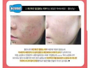 Shocking toner