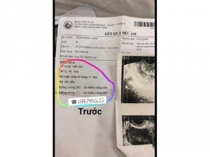 Viên uống điều kinh gia truyền HẰNG THU