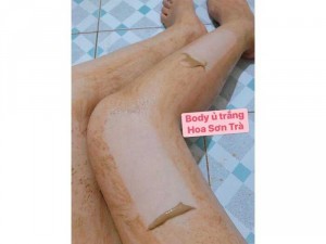 Combo Ủ Trắng Collagen
