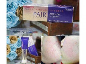 Kem trị mụn pair nhật bản sỉ lẻ toàn quốc
