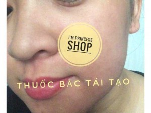Trị mụn,nám, tàn nhang