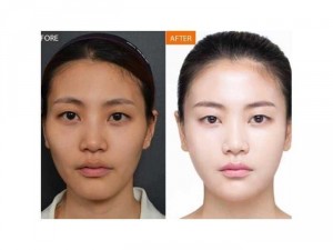 TINH Chất collagen C trắng da ngừa nám