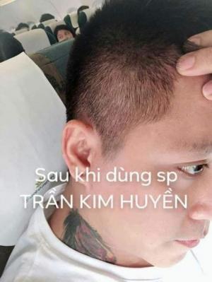 Bộ sản phẩm trị nấm da đầu