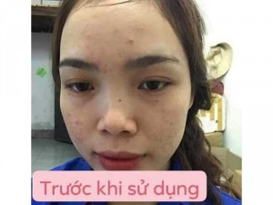 Mỡ trăn N'store