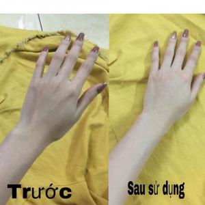 Trước và sau khi dùng sản phẩm