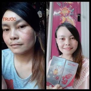 Công dụng sản phẩm