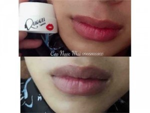 Ủ môi hồng Queen