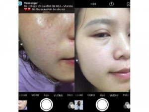 Tế bào gốc_vi tảo lục M'white