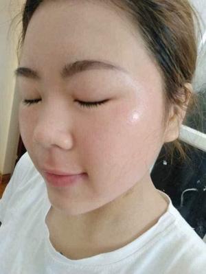 Bộ trị mụn đông y của MAGICSKIN