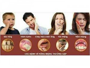 Tinh dầu thảo dược dr. Smile