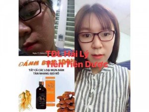 Đặc trị mụn thâm nám tàn nhang - cam kết ko hết hoàn tiền 100%
