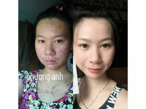 Thảo dược tái tạo da Phương Anh
