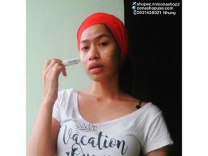 Kem Retin A 0.05% (Tretinoin 0.05%)- Kem Vitacid Retinoic Acid 0.05%