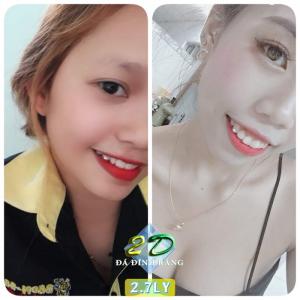 Trang sức đá swarovski dùng để đính răng 3.0ly