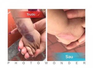 TÊ BÀO GỐC thực vật - SUPPER -