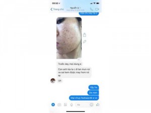 Feeback Kem trị nám dưỡng trắng da, trị mun TICHI , lancomai sham_sely