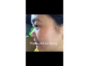 Kem Face Làm Mờ Nám Tàn Nhang Jussmy HM Store