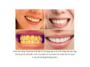 Nước Súc Miệng Nhật Bản Hàng Xách Tay Chính Hãng