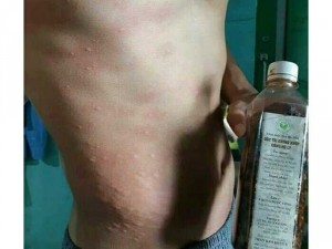 Xoa bóp thảo mộc