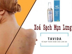 Men vi sinh Tavida sạch viêm nang lông