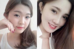 Nhấn Mí Mắt ở đâu đẹp