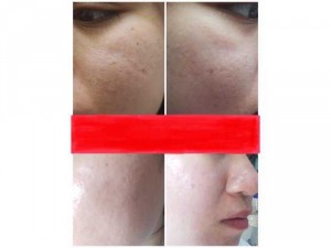 Tinh chất trắng da stone rose stem cell hàn quốc