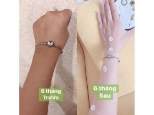 Kem trắng da body bơ