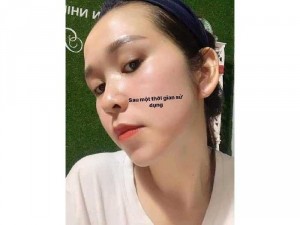 Ủ trắng face kavia