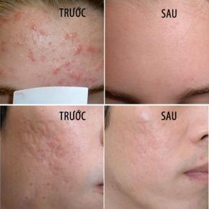 Hiệu quả khi sử dụng trên da.