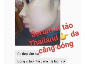 Surum vi tảo biển
