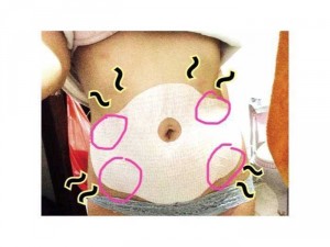 Miếng dán giảm mỡ bụng Mymi Wonder patch