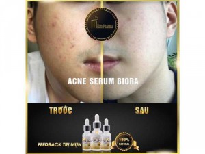 Đặc Trị Mụn Acne Serum Biora