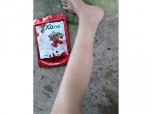 Tắm trắng Kone'